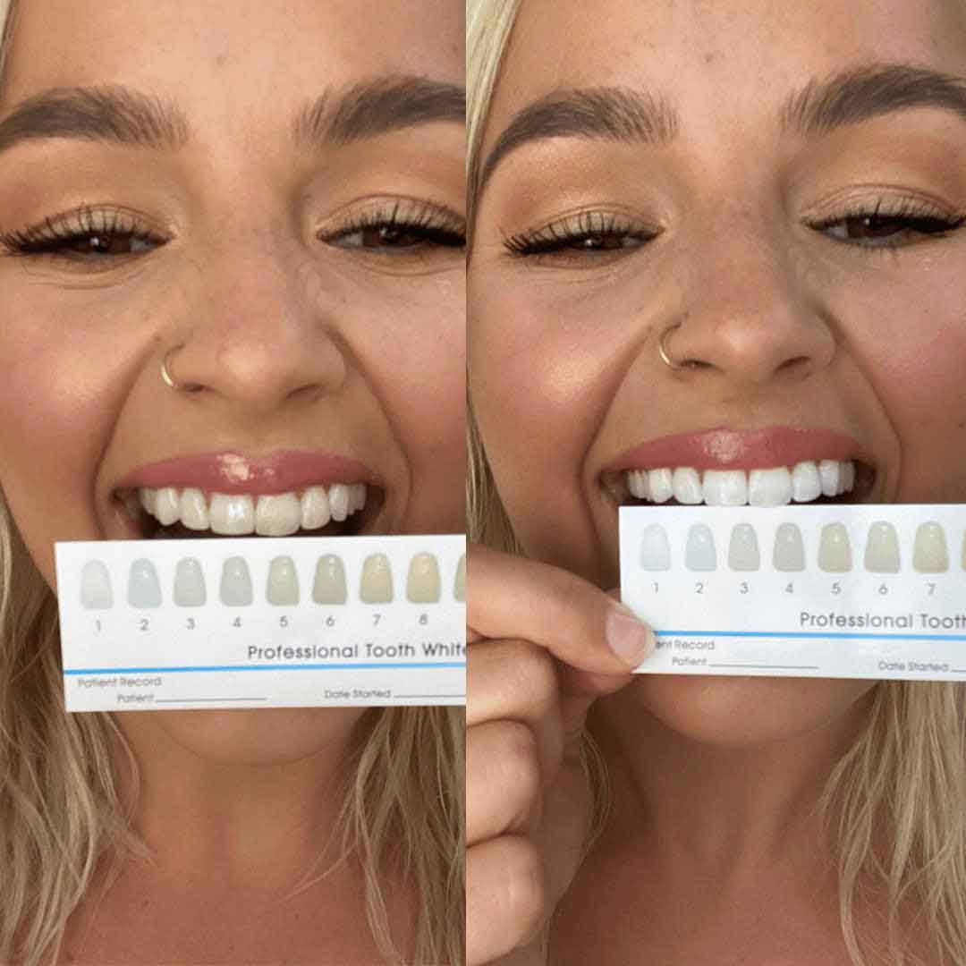 SmilePro Whitening Toothpaste
