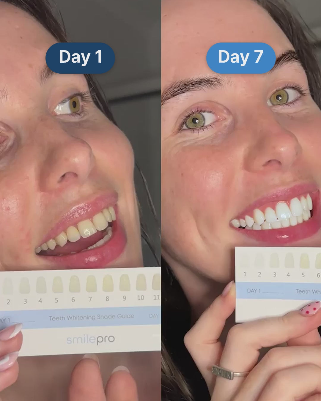 A SmilePro customer on day 1 and day 7 of the Advanced Teeth Whitening Kit, holding the shade guide.